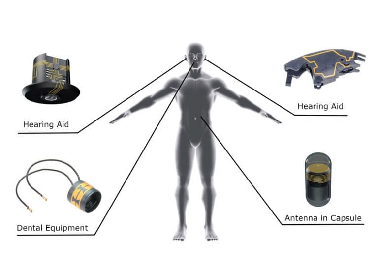 La tecnologia 3D-MID di Harting permette di realizzare sensori da inserire all’interno del corpo del paziente