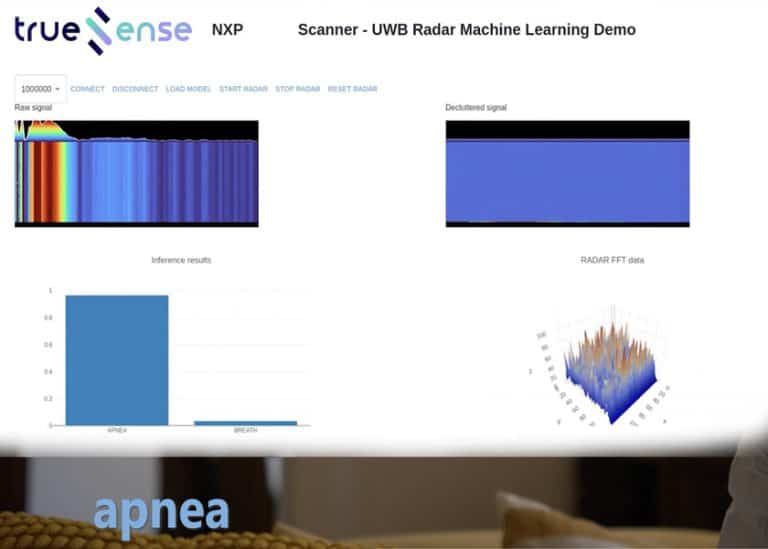 La piattaforma Truesense con hardware NXP per il rilevamento delle apnee notturne in mostra a embedded world 2024